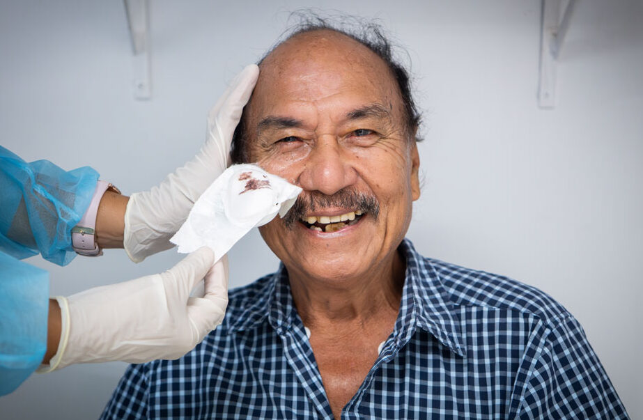Seiuli having his eye bandage removed after cataract surgery