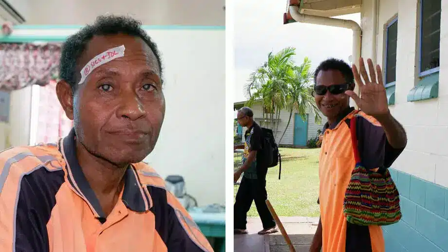 Left: Cornelius before surgery with visible cataracts in both of his eyes. Right: Cornelius all smiles leaving the outreach after two successful eye operations.