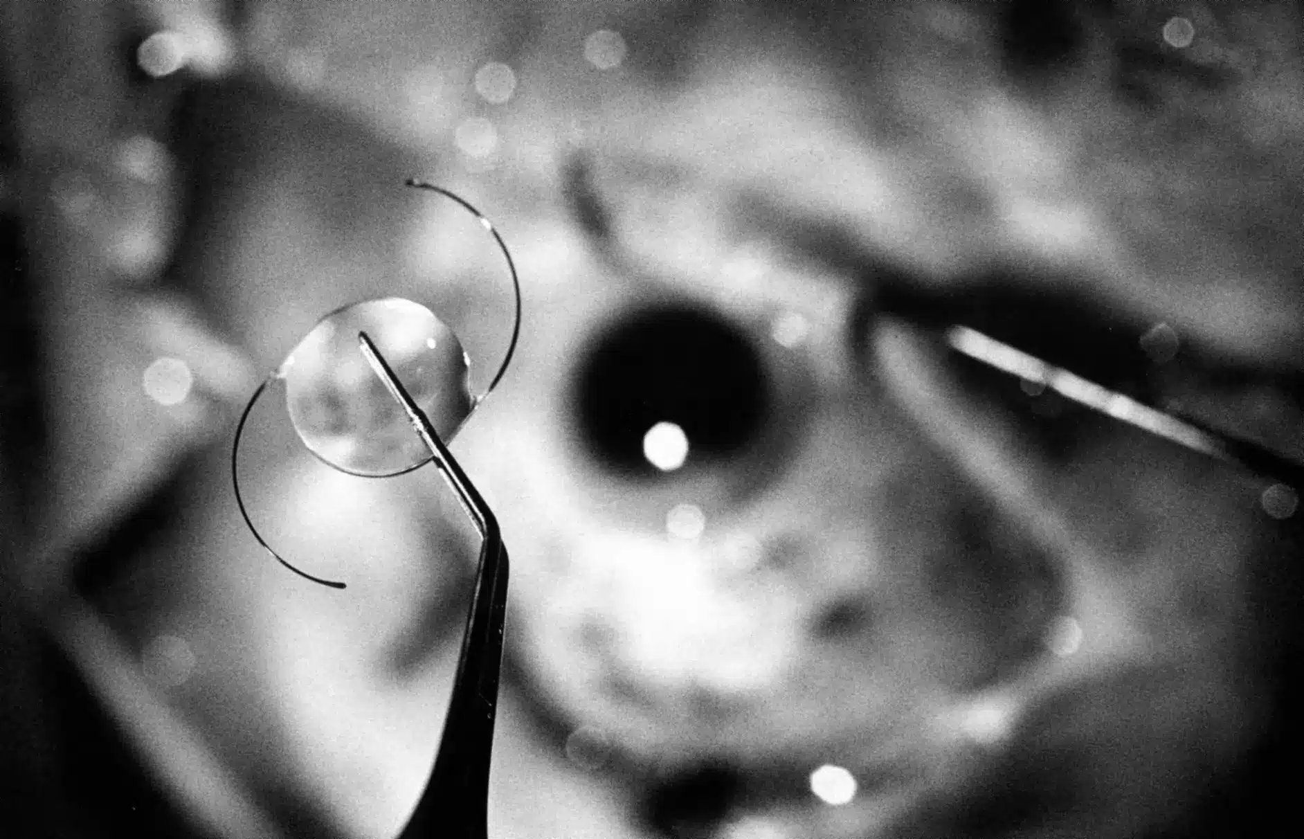 Close up of an IOL (intraocular lens)