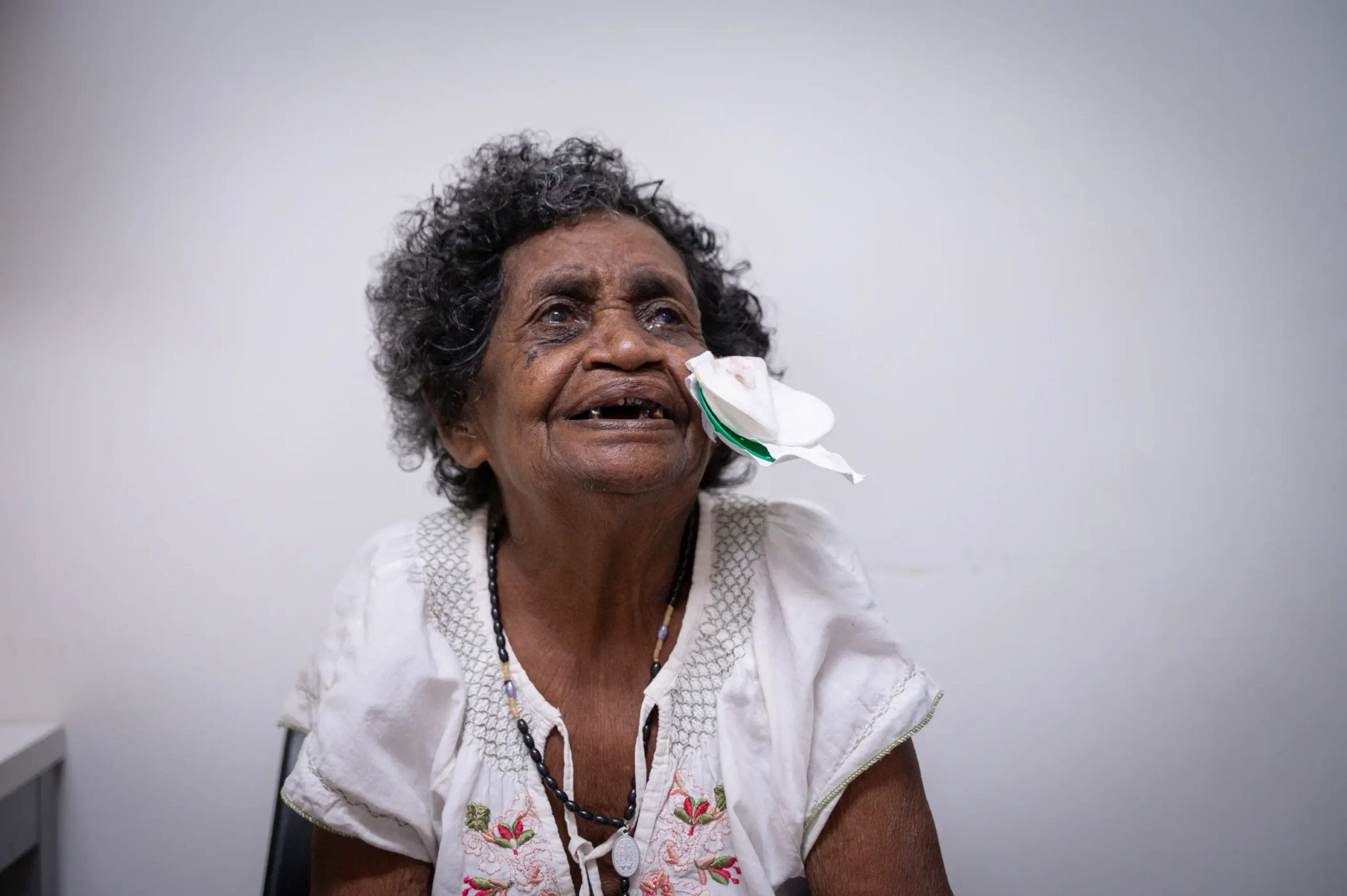 Philomena seeing for the first time after having her bandage removed