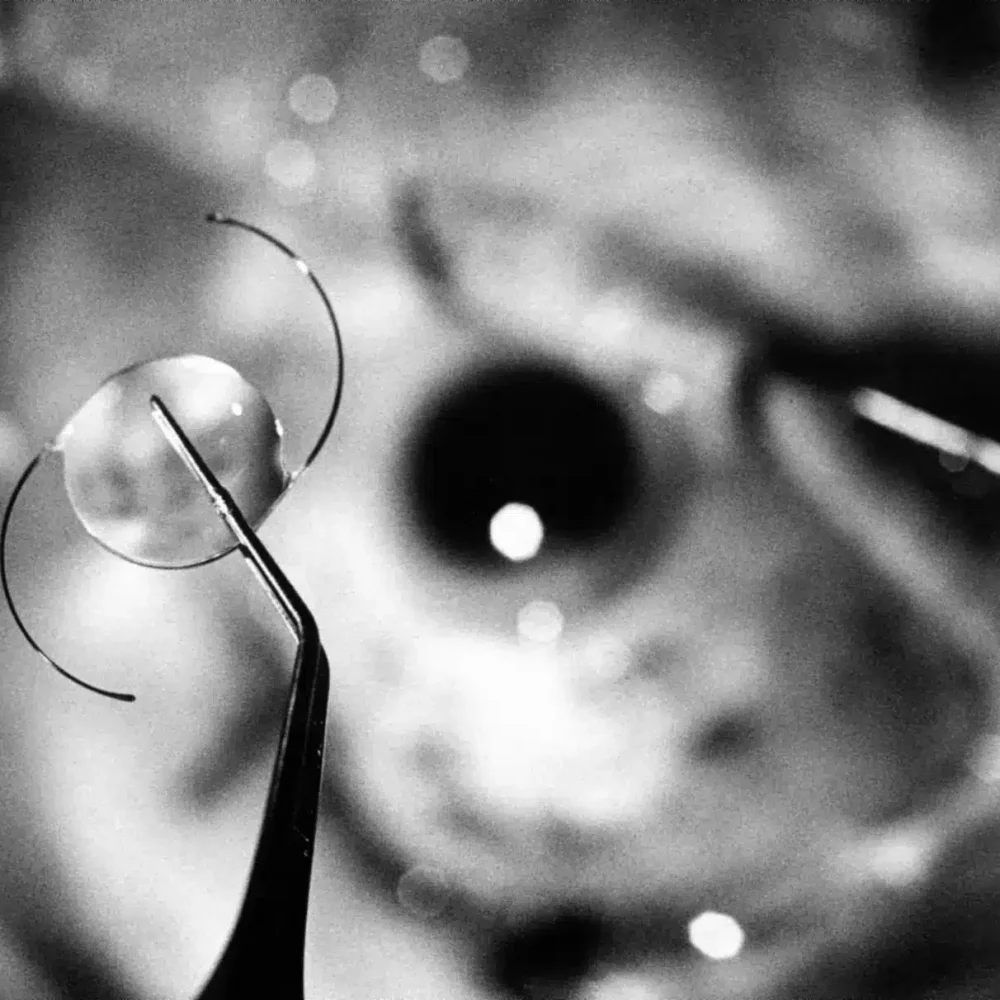 Close up of an IOL (intraocular lens)